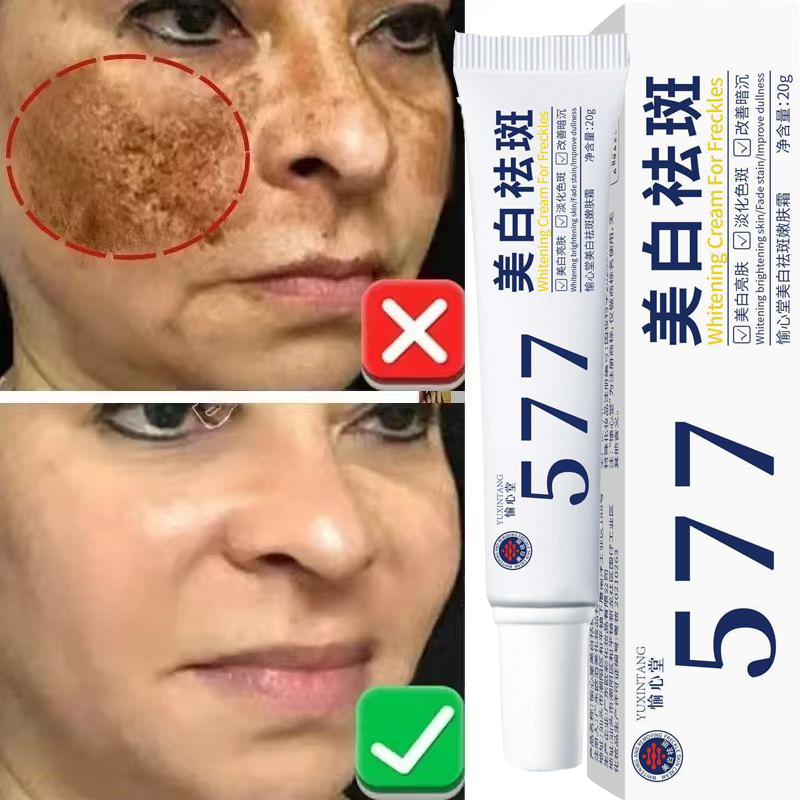 Korean Lifestyle Products - Beyazlatıcı Çil Kremi Melazma Koyu Leke