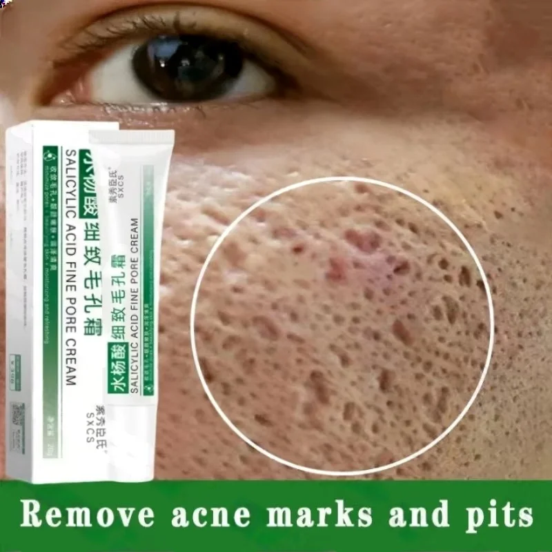 Salisilik Asit Gözenek Temizle - Korean Lifestyle Products incelemesi ve fiyatı