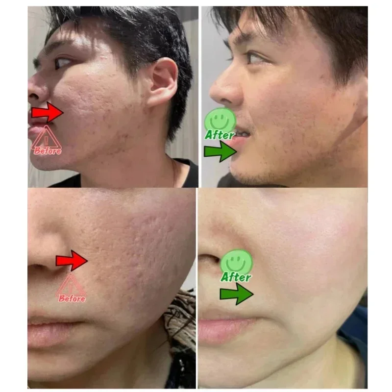 Salisilik Asit Gözenek Temizle - Korean Lifestyle Products incelemesi ve fiyatı