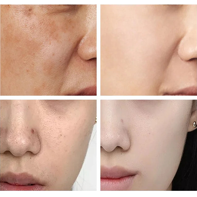 SPF90 + Güneş Koruyucu Kore Be - Korean Lifestyle Products incelemesi ve fiyatı