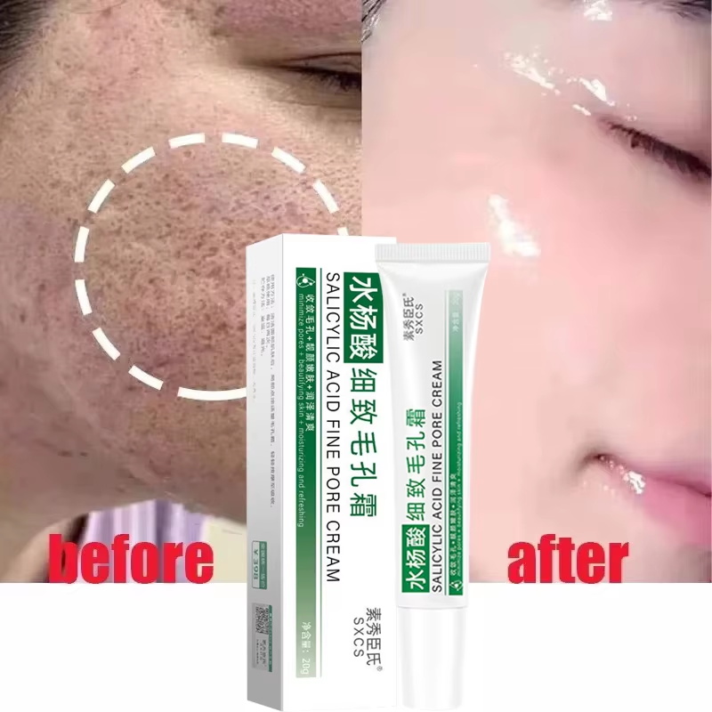 Salisilik Asit Gözenek Sıkılaş - Korean Lifestyle Products incelemesi ve fiyatı