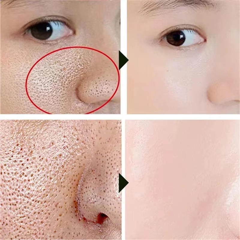 Salisilik Asit Gözenek Sıkılaş - Korean Lifestyle Products incelemesi ve fiyatı